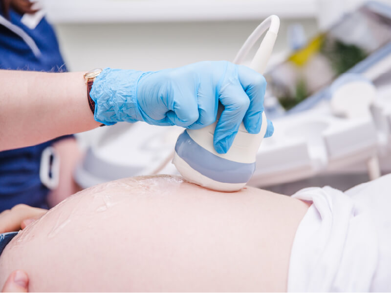 胎児精密超音波検査のイメージ